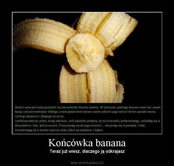 Końcówka banana – Teraz już wiesz, dlaczego ją odkrajasz 