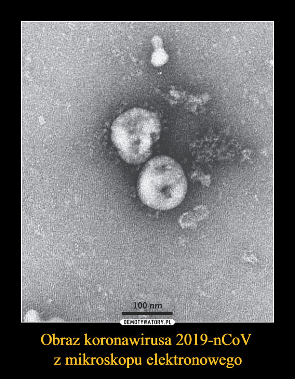 Obraz koronawirusa 2019-nCoV z mikroskopu elektronowego –  