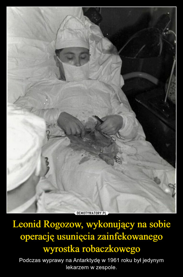 Leonid Rogozow, wykonujący na sobie operację usunięcia zainfekowanego wyrostka robaczkowego